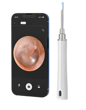 Load image into Gallery viewer, EarLite P7