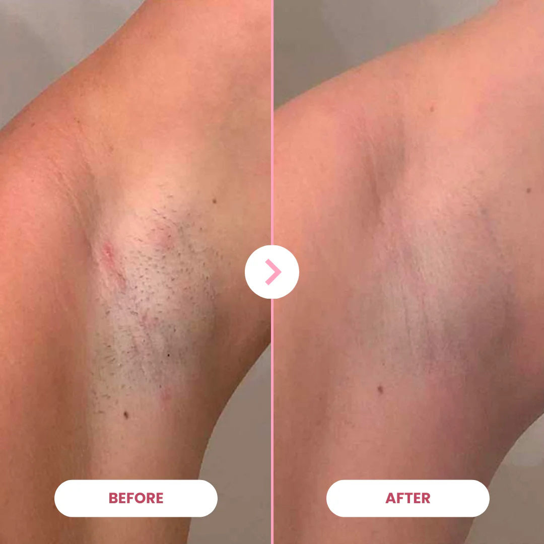 1x EpiLuxe Epilator